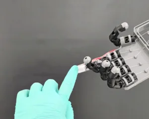 Gloved finger points at a gray modular robotic hand with joints inside a case.